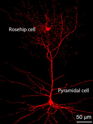 Illustration for article titled Identifican un nuevo tipo de neurona exclusiva del cerebro humano que podría influir en la percepción